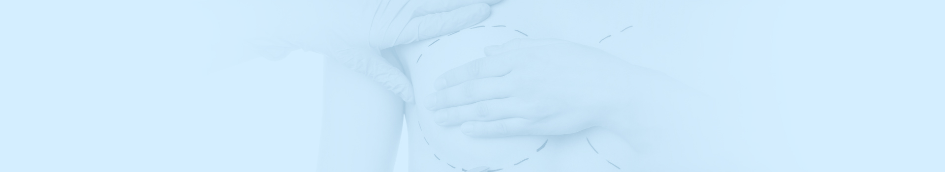 Breast surgery consultation and planning in Istanbul